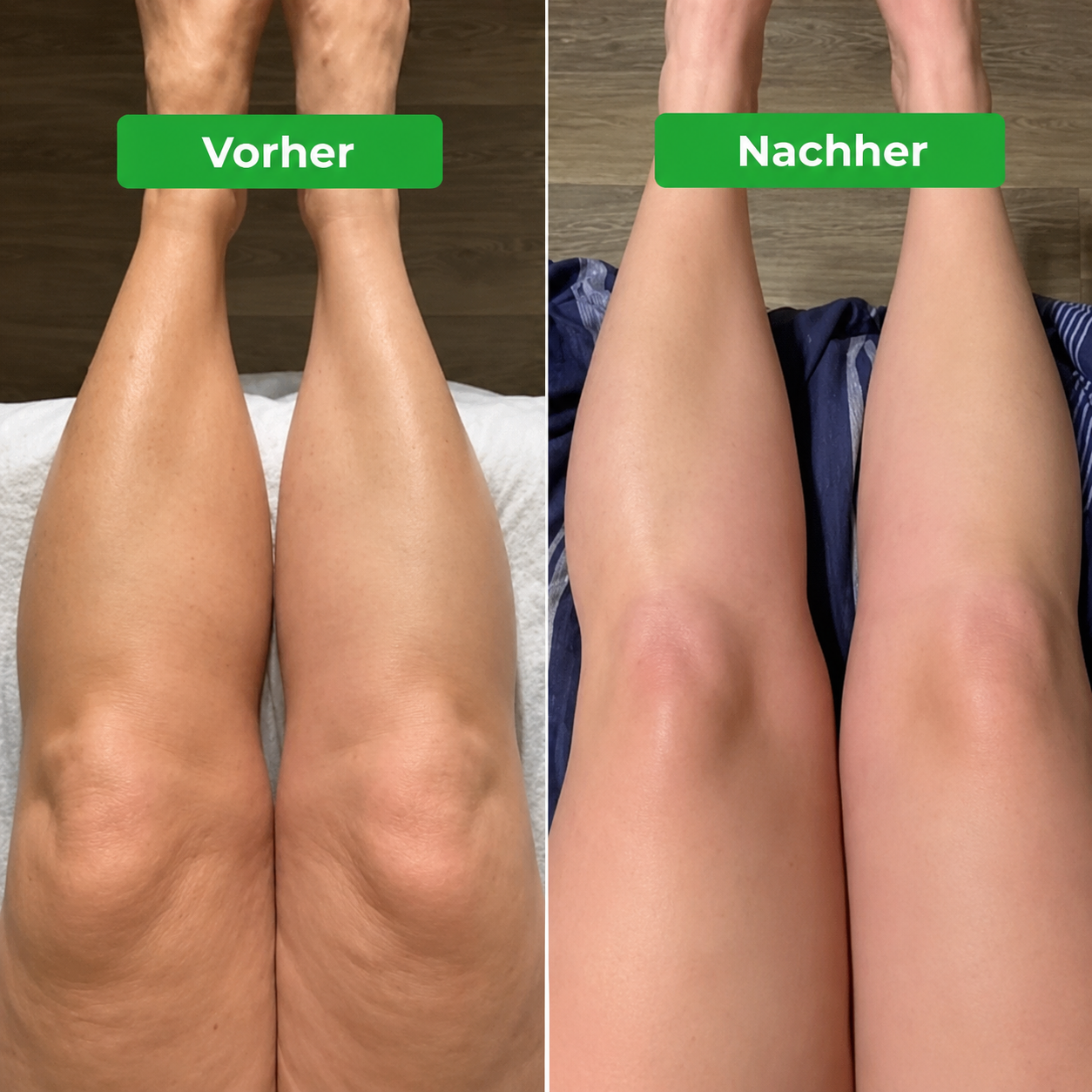 Lymphdrainage Liora +